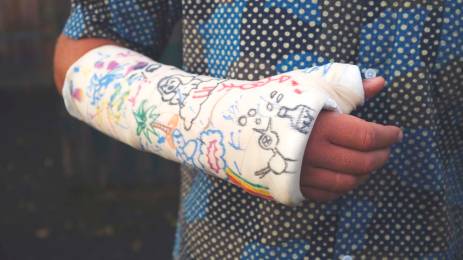 Hånd med gips som er dekorert av tegninger i forskjellige farger